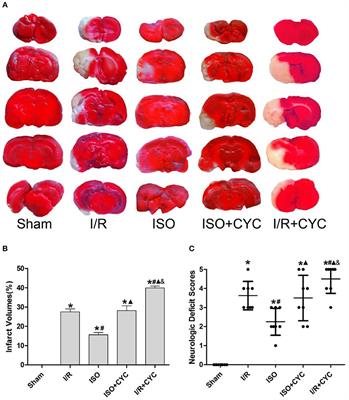 Isoflurane Post-conditioning Ameliorates Cerebral Ischemia/Reperfusion Injury by Enhancing Angiogenesis Through Activating the Shh/Gli Signaling Pathway in Rats